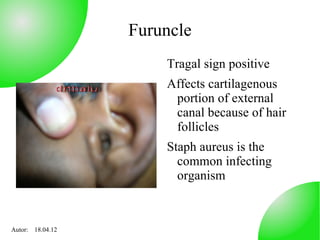 Furuncle
                      Tragal sign positive
                      Affects cartilagenous
                       portion of external
                       canal because of hair
                       follicles
                      Staph aureus is the
                        common infecting
                        organism



Autor: 18.04.12
 