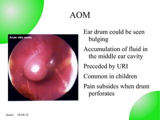 AOM
                    Ear drum could be seen
                     bulging
                    Accumulation of fluid in
                     the middle ear cavity
                    Preceded by URI
                    Common in children
                    Pain subsides when drum
                      perforates


Autor: 18.04.12
 