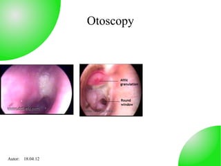 Otoscopy




Autor: 18.04.12
 