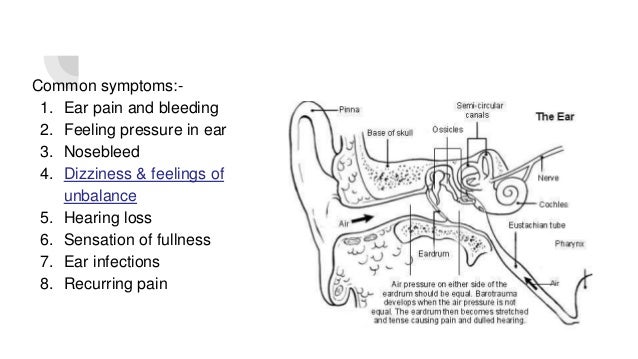 barotrauma ear bombing barotrauma ear bombing