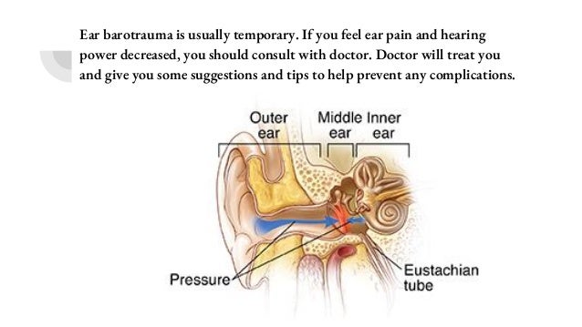 inner ear barotrauma treatment