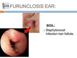 Ear and its clinical correlations By Dr. Rabia Inam Gandapore.pptx
