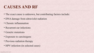Classified as Microsoft
CAUSES AND RF
• The exact cause is unknown, but contributing factors include:
• DNA damage from ultraviolet radiation
• Chronic inflammation
• Recurrent ear infections
• Genetic mutations
• Exposure to carcinogens
• Previous radiation therapy
• HPV infection (in selected cases)
 