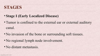 Classified as Microsoft
STAGES
•Stage I (Early Localized Disease)
•Tumor is confined to the external ear or external auditory
canal.
•No invasion of the bone or surrounding soft tissues.
•No regional lymph node involvement.
•No distant metastasis.
 
