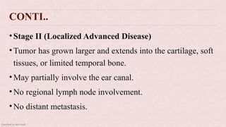 Classified as Microsoft
CONTI..
•Stage II (Localized Advanced Disease)
•Tumor has grown larger and extends into the cartilage, soft
tissues, or limited temporal bone.
•May partially involve the ear canal.
•No regional lymph node involvement.
•No distant metastasis.
 