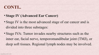 Classified as Microsoft
CONTI..
•Stage IV (Advanced Ear Cancer)
•Stage IV is the most advanced stage of ear cancer and is
divided into three substages:
•Stage IVA: Tumor invades nearby structures such as the
inner ear, facial nerve, temporomandibular joint (TMJ), or
deep soft tissues. Regional lymph nodes may be involved.
 
