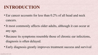Classified as Microsoft
INTRODUCTION
• Ear cancer accounts for less than 0.2% of all head and neck
cancers.
• It most commonly affects older adults, although it can occur at
any age.
• Because its symptoms resemble those of chronic ear infections,
diagnosis is often delayed.
• Early diagnosis greatly improves treatment success and survival
 