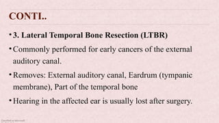 Classified as Microsoft
CONTI..
•3. Lateral Temporal Bone Resection (LTBR)
•Commonly performed for early cancers of the external
auditory canal.
•Removes: External auditory canal, Eardrum (tympanic
membrane), Part of the temporal bone
•Hearing in the affected ear is usually lost after surgery.
 