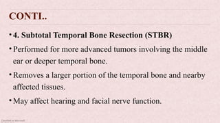 Classified as Microsoft
CONTI..
•4. Subtotal Temporal Bone Resection (STBR)
•Performed for more advanced tumors involving the middle
ear or deeper temporal bone.
•Removes a larger portion of the temporal bone and nearby
affected tissues.
•May affect hearing and facial nerve function.
 