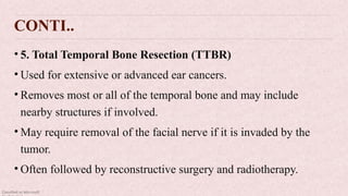 Classified as Microsoft
CONTI..
• 5. Total Temporal Bone Resection (TTBR)
• Used for extensive or advanced ear cancers.
• Removes most or all of the temporal bone and may include
nearby structures if involved.
• May require removal of the facial nerve if it is invaded by the
tumor.
• Often followed by reconstructive surgery and radiotherapy.
 