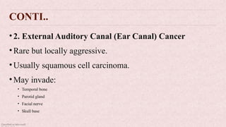 Classified as Microsoft
CONTI..
•2. External Auditory Canal (Ear Canal) Cancer
•Rare but locally aggressive.
•Usually squamous cell carcinoma.
•May invade:
• Temporal bone
• Parotid gland
• Facial nerve
• Skull base
 