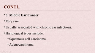 Classified as Microsoft
CONTI..
•3. Middle Ear Cancer
•Very rare.
•Usually associated with chronic ear infections.
•Histological types include:
•Squamous cell carcinoma
•Adenocarcinoma
 