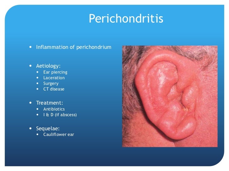 Ear disease presentation (manchester g ps)
