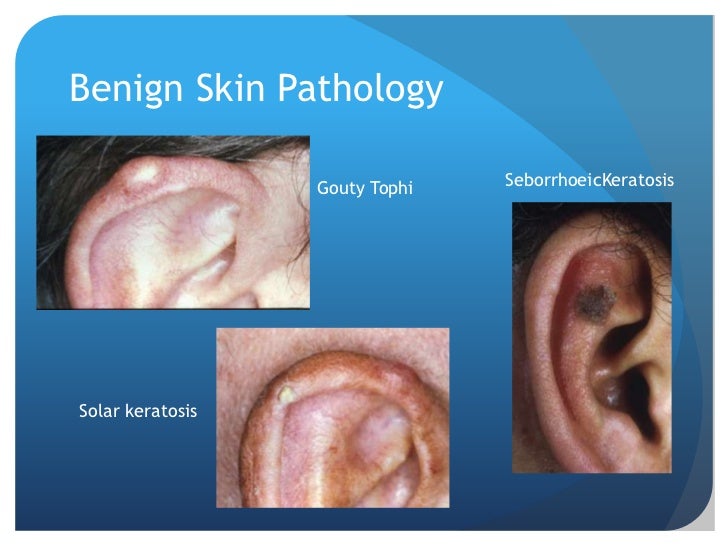 Ear disease presentation (manchester g ps)