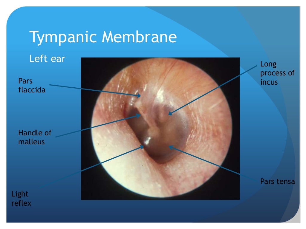 Ear disease presentation (manchester g ps)