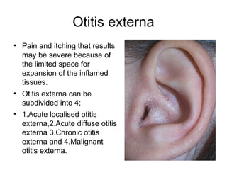Ear Diseases.pptx .Ear diseases pathanatomy MBBS student | PPTX
