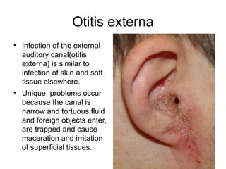 Ear Diseases.pptx .Ear diseases pathanatomy MBBS student | PPTX