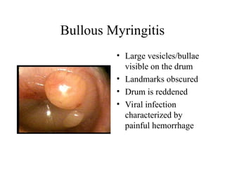 ear exam andthengobacktoworkandgetai.ppt