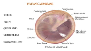 TYMPANICMEMBRANE
COLOR
SHAPE
QUADRANTS
VERTICAL DM
HORIZONTAL DM
 