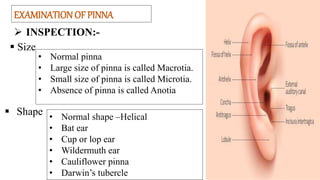 EXAMINATION OF PINNA
 INSPECTION:-
 Size
 Shape • Normal shape –Helical
• Bat ear
• Cup or lop ear
• Wildermuth ear
• Cauliflower pinna
• Darwin’s tubercle
• Normal pinna
• Large size of pinna is called Macrotia.
• Small size of pinna is called Microtia.
• Absence of pinna is called Anotia
 