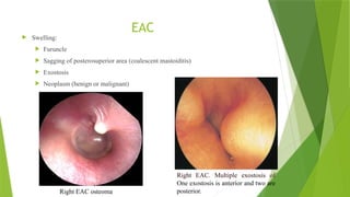 Physical examination of ear | PPTX