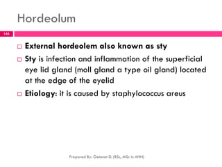 Hordeolum
 External hordeolem also known as sty
 Sty is infection and inflammation of the superficial
eye lid gland (moll gland a type oil gland) located
at the edge of the eyelid
 Etiology: it is caused by staphylococcus areus
Prepared By: Getenet D. (BSc, MSc in AHN)
145
 