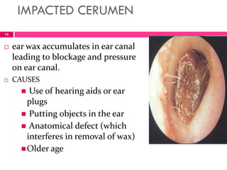 IMPACTED CERUMEN
 ear wax accumulates in ear canal
leading to blockage and pressure
on ear canal.
 CAUSES
 Use of hearing aids or ear
plugs
 Putting objects in the ear
 Anatomical defect (which
interferes in removal of wax)
Older age
16
 