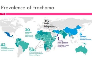 Prevalence of trachoma
193
 