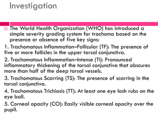 Investigation
 The World Health Organization (WHO) has introduced a
simple severity grading system for trachoma based on the
presence or absence of five key signs:
1. Trachomatous Inflammation–Follicular (TF): The presence of
five or more follicles in the upper tarsal conjunctiva.
2. Trachomatous Inflammation–Intense (TI): Pronounced
inflammatory thickening of the tarsal conjunctiva that obscures
more than half of the deep tarsal vessels.
3. Trachomatous Scarring (TS): The presence of scarring in the
tarsal conjunctiva.
4. Trachomatous Trichiasis (TT): At least one eye lash rubs on the
eye ball.
5. Corneal opacity (CO): Easily visible corneal opacity over the
pupil.
 