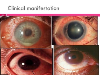Clinical manifestation
231
 