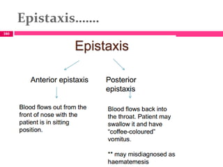 Epistaxis…….
280
 