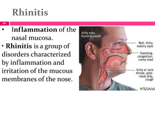 Rhinitis
291
• Inflammation of the
nasal mucosa.
• Rhinitis is a group of
disorders characterized
by inflammation and
irritation of the mucous
membranes of the nose.
 