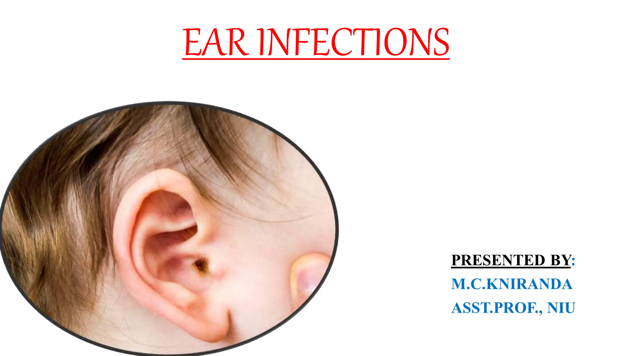 EAR INFECTIONS otitis media middle ear infection.pptx