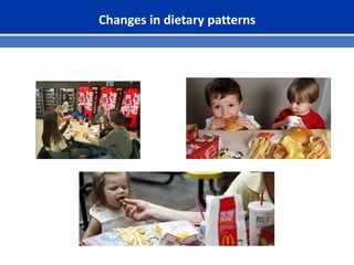 Changes in dietary patterns
 