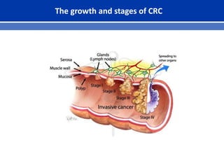 The growth and stages of CRC
 
