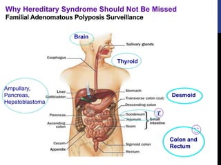 Ampullary,
Pancreas,
Hepatoblastoma
Colon and
Rectum
Familial Adenomatous Polyposis Surveillance
Thyroid
Brain
Desmoid
/
Why Hereditary Syndrome Should Not Be Missed
 