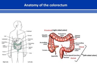 Anatomy of the colorectum
(right-sided colon)
(left-sided colon)
 