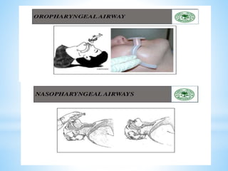 Early assessment and management of major trauma | PPTX