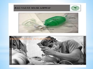 Early assessment and management of major trauma | PPTX