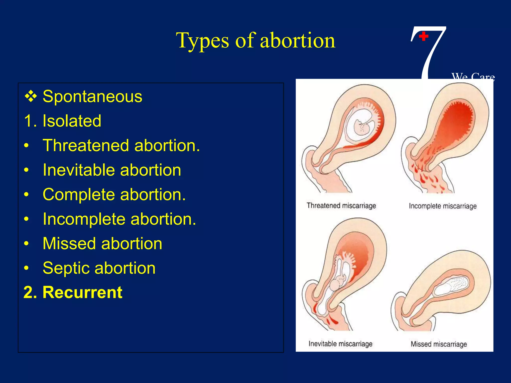 Bleeding in early pregnancy | PPTX