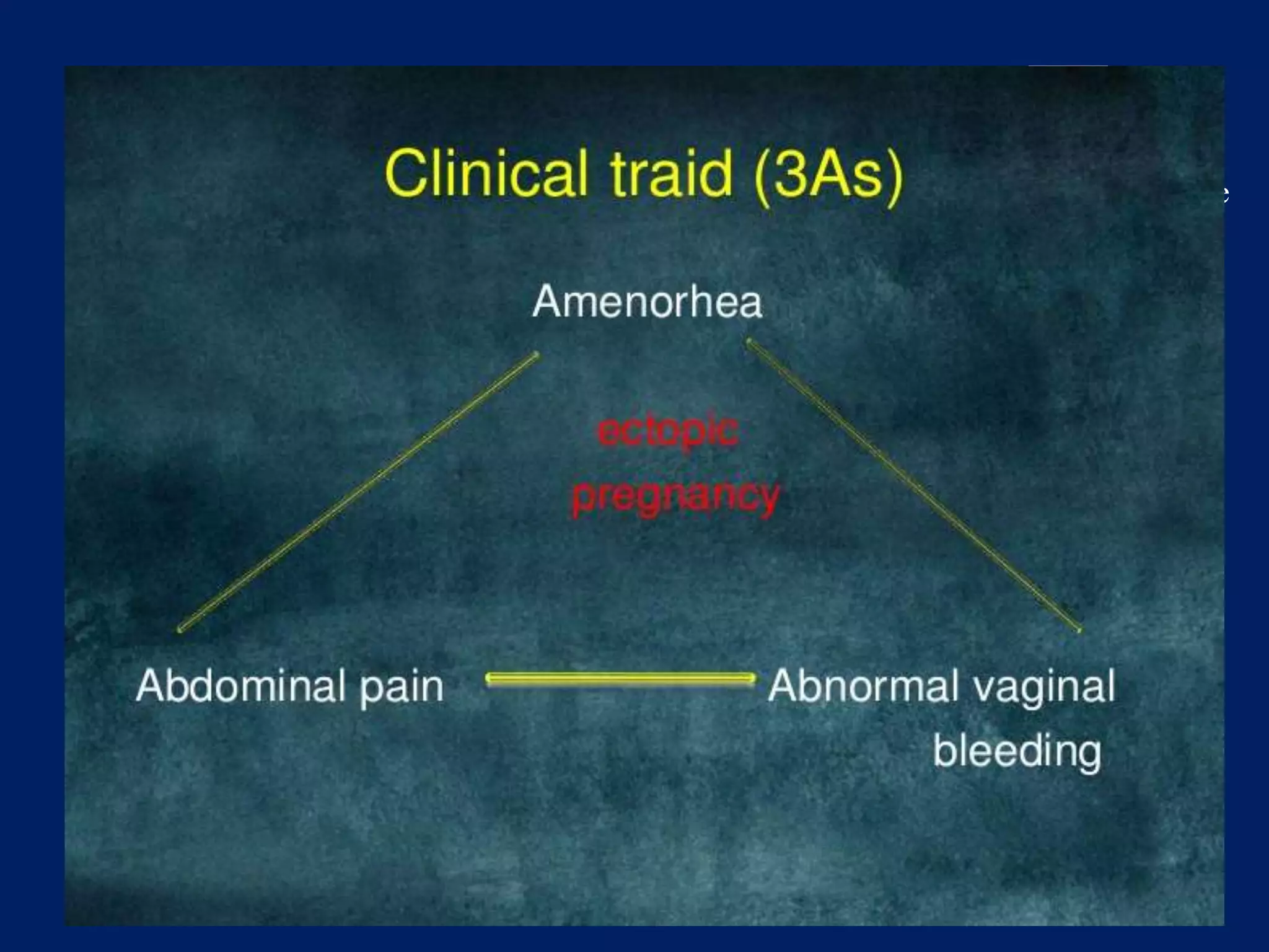 Bleeding in early pregnancy | PPTX