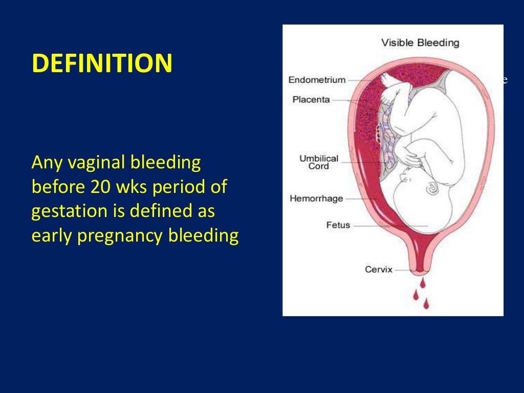 Bleeding in early pregnancy