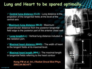 Distance Chest Early breast cancer | PPTX