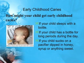 Early Childhood Caries If your child sleeps with a bottle.  If your child has a bottle for long periods during the day.  If you child sucks on a pacifier dipped in honey, syrup or anything sweet.   How might your child get early childhood caries? 