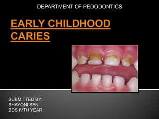DEPARTMENT OF PEDODONTICS

SUBMITTED BY:
SHAYONI SEN
BDS IVTH YEAR

 