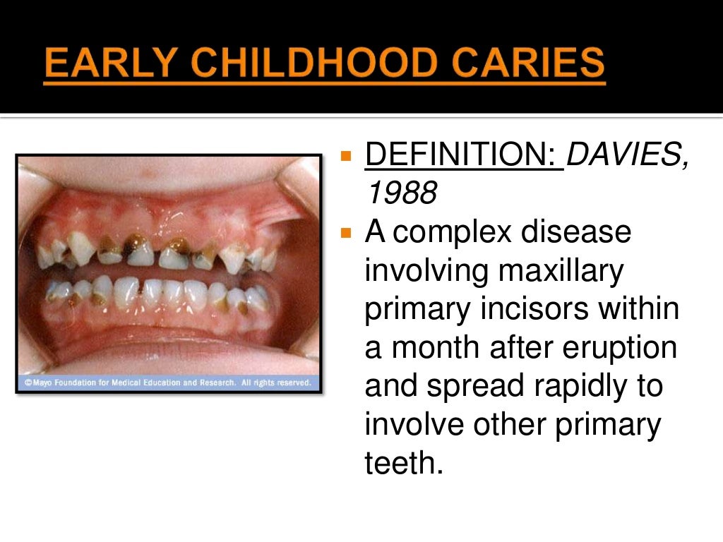 Early Childhood Caries Early childhood caries