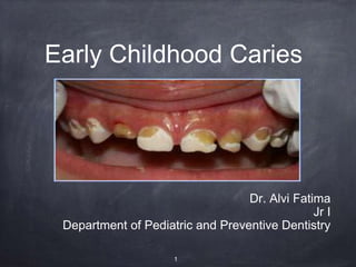 Early Childhood Caries
Dr. Alvi Fatima
Jr I
Department of Pediatric and Preventive Dentistry
1
 