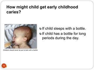 If child sleeps with a bottle.
If child has a bottle for long
periods during the day.
How might child get early childhood
caries?
10
 