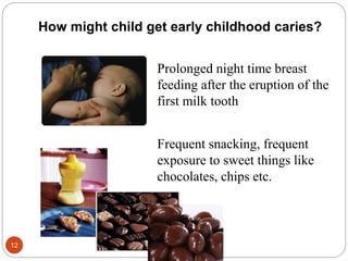 How might child get early childhood caries?
Prolonged night time breast
feeding after the eruption of the
first milk tooth
Frequent snacking, frequent
exposure to sweet things like
chocolates, chips etc.
12
 