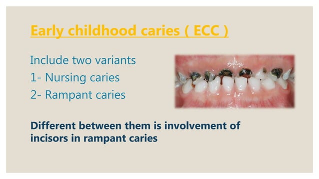 Early childhood caries, rampant, chronic and arrested caries | PPTX ...